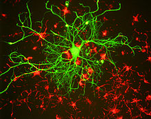 Human Neurofilament H ELISA Kit (200 kDa Neurofilament protein)
